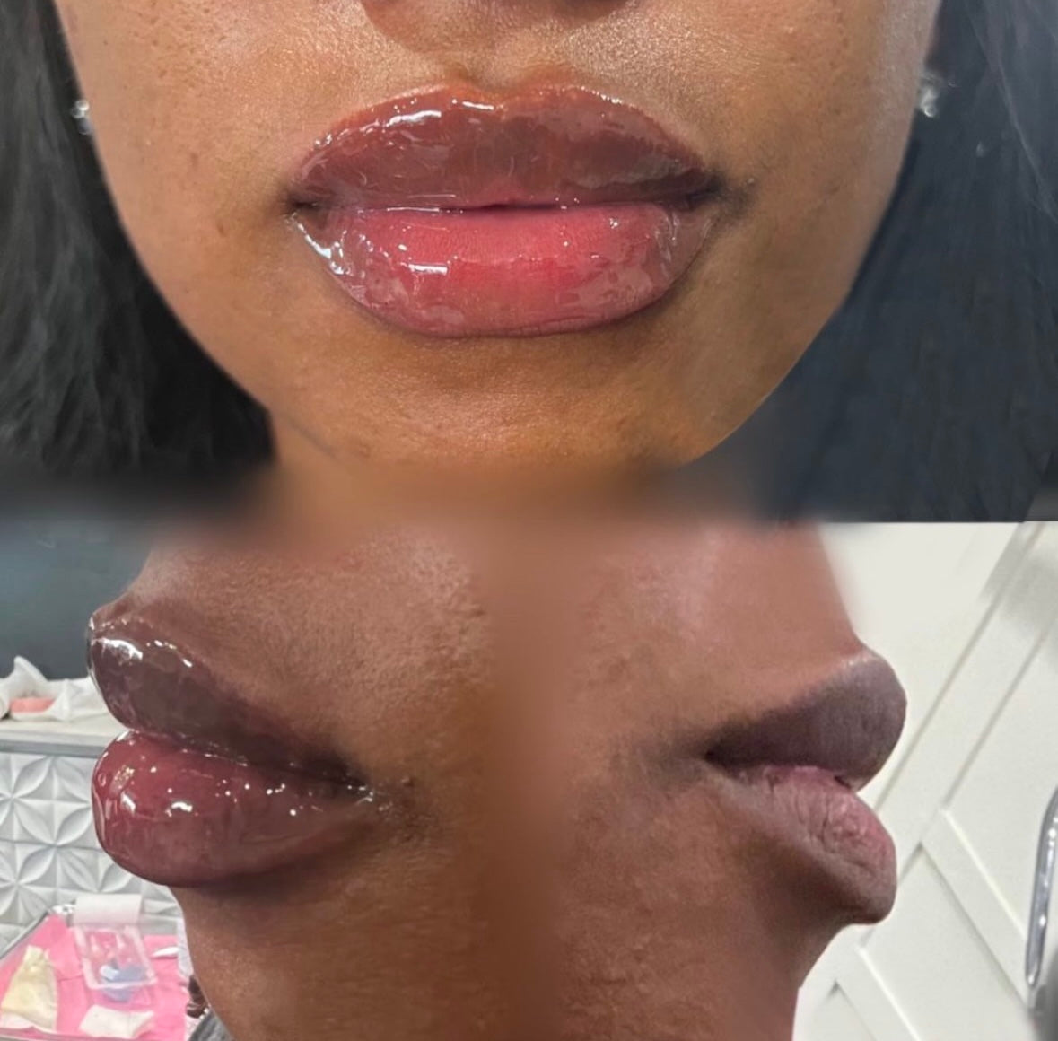 Puckered up lip plumper